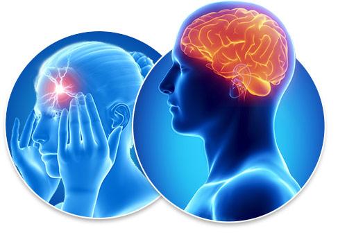 头痛的按摩治疗方法