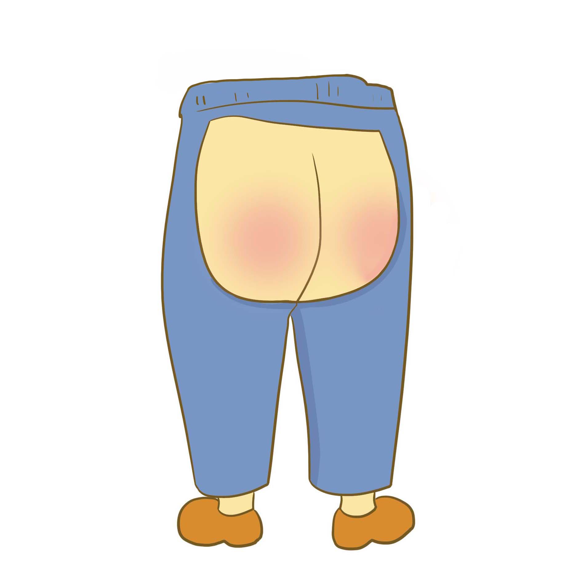 宝宝屁屁一直都是青色的,婴儿纸尿裤屁屁红红的