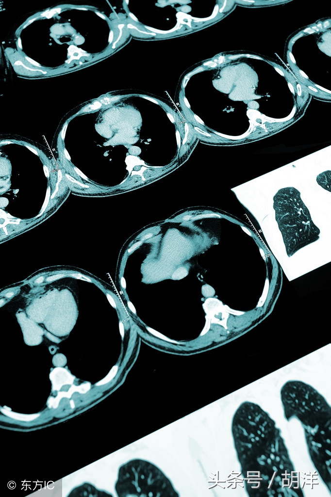 痰中带血好害怕,痰中带血要不要紧