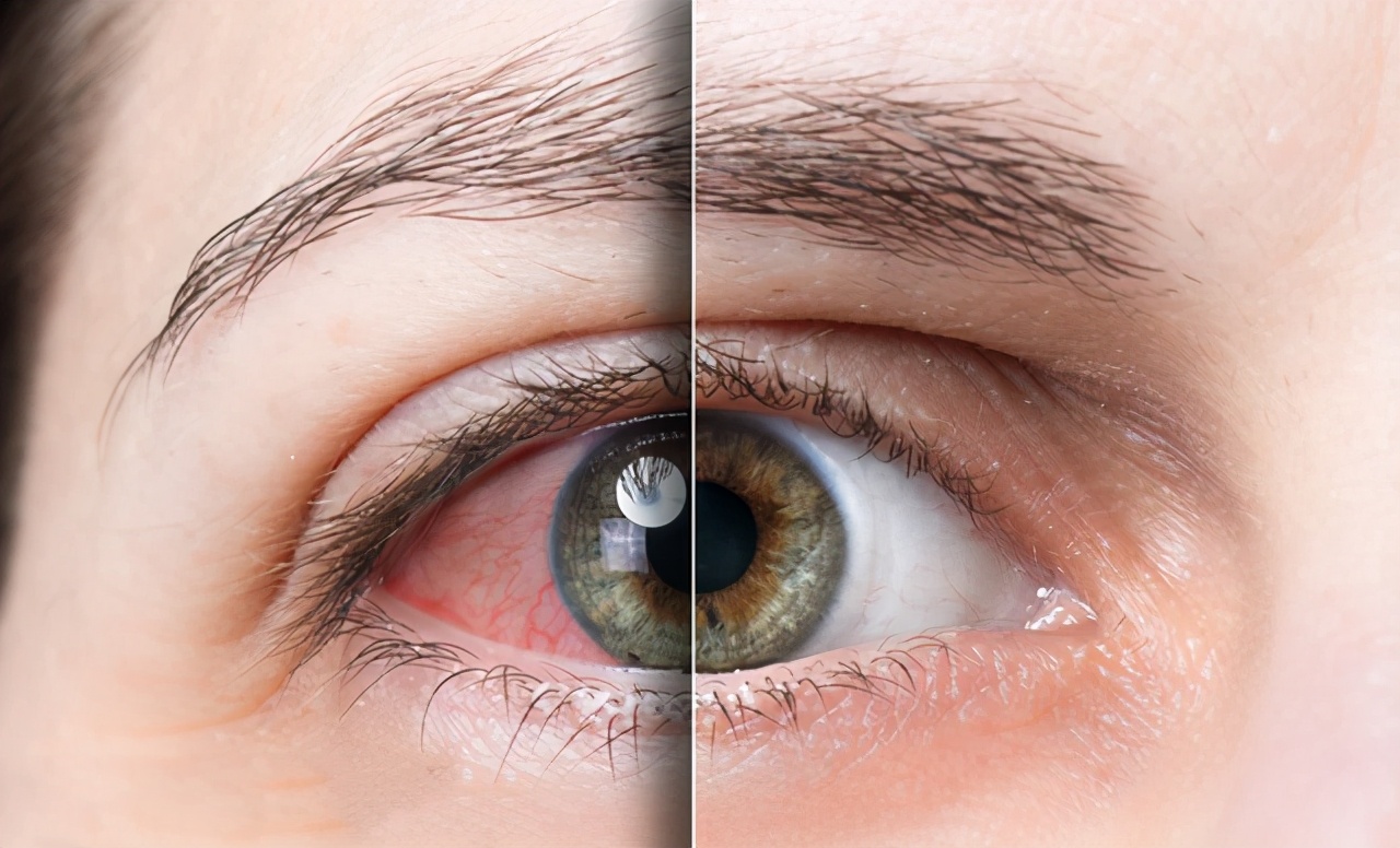 难以入睡少眠多梦发虚汗胸闷气短,经常心慌胸闷气短心悸怎么改善