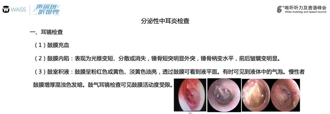 WASS峰会｜针对病因有效治疗，可改善部分儿童的听力损失