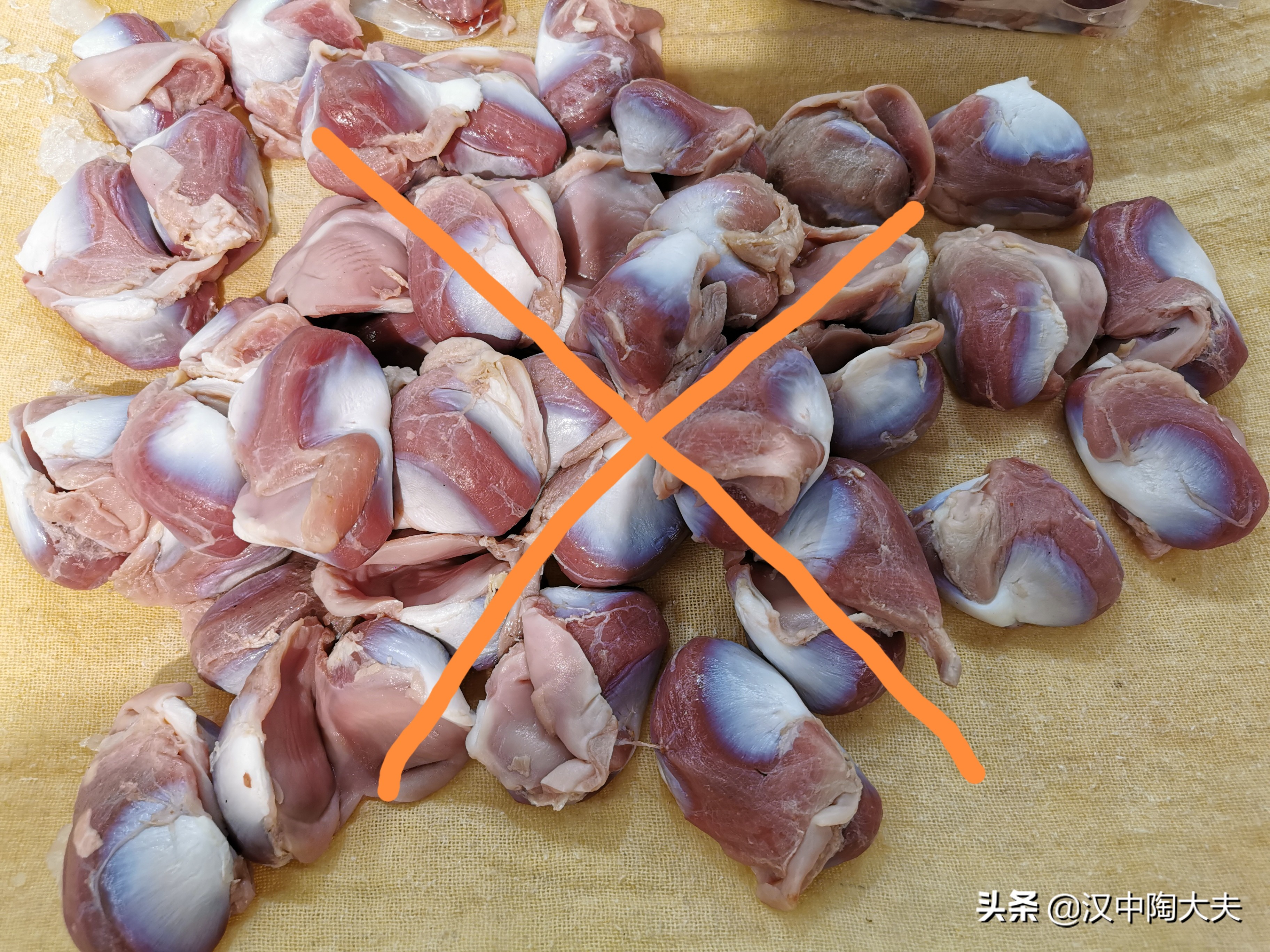 尿酸460到510怎么办,男性尿酸534严重吗要吃药降尿酸吗