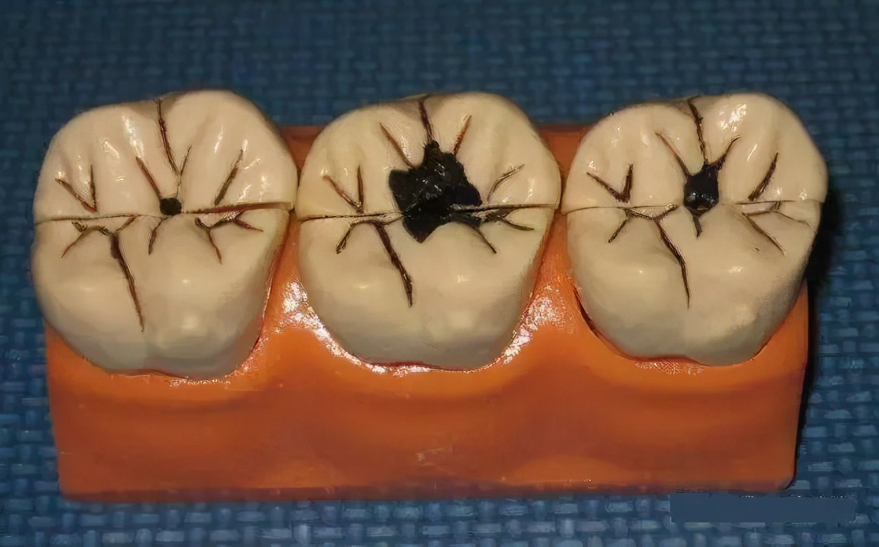 牙痛怎么办早期三大症状,请说出牙痛九个诱因