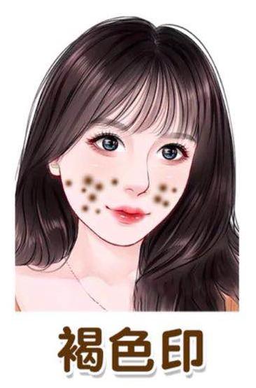 有效简单的祛除痘印的方法,6大方法有效祛除痘印