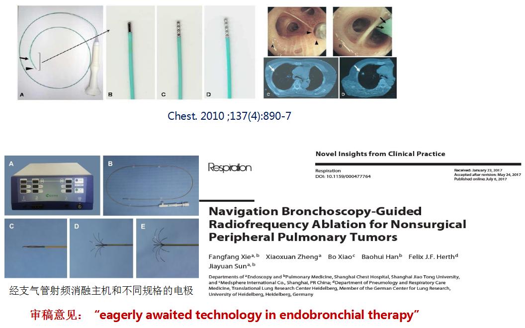支气管镜高频电刀治疗中央型肺癌,支气管镜在早期肺癌诊断的意义