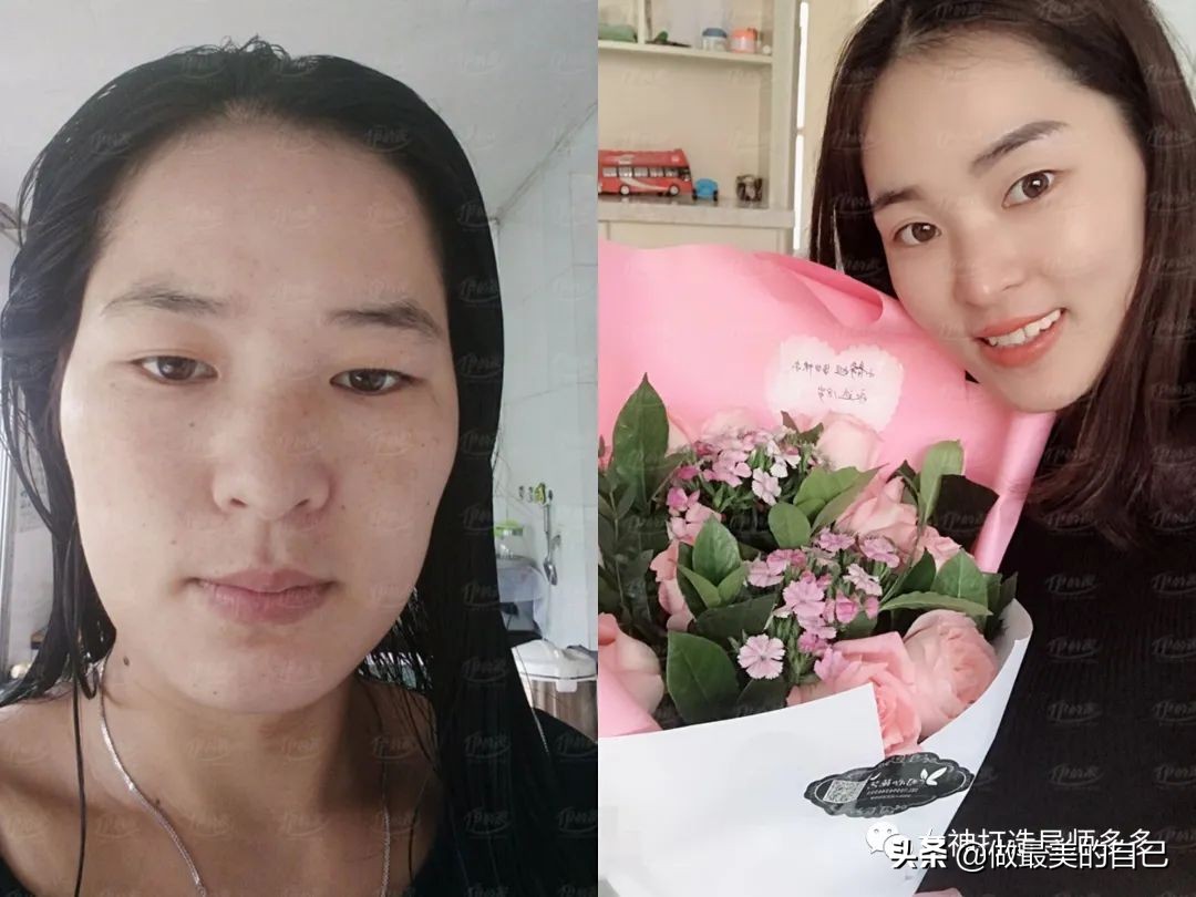 斑点暗黄肌最全的改善小技巧，都在这里