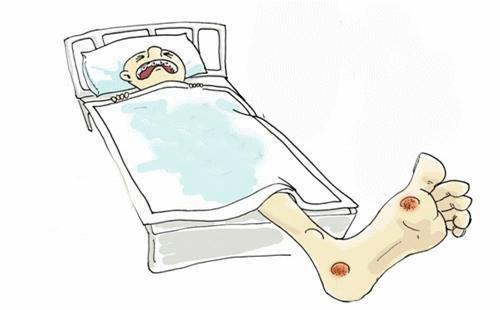 双脚肿是什么病的前兆,双脚肿疼痛是什么原因引起的