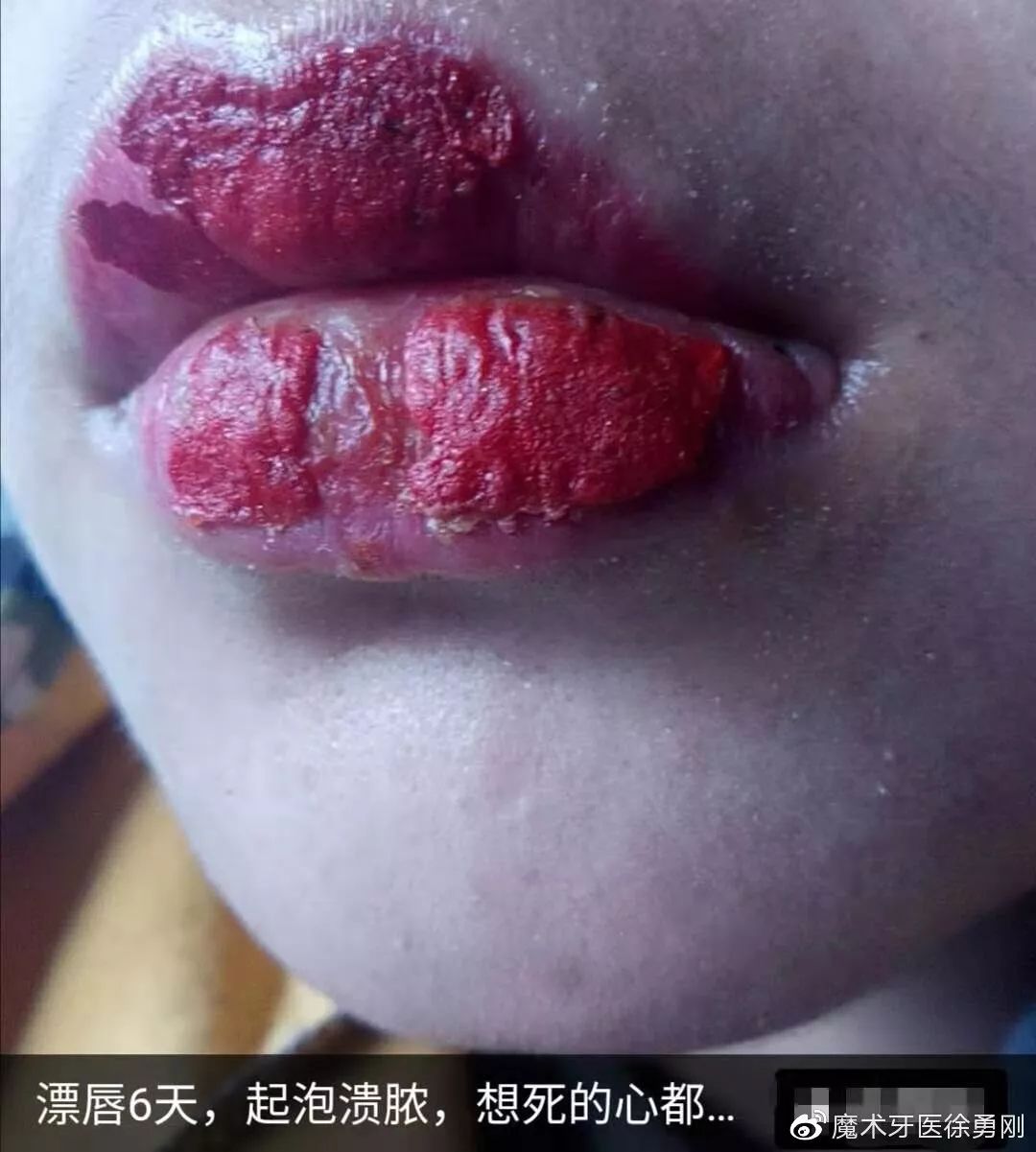 内行人为什么不建议漂唇,作为一名医生一直被人质疑