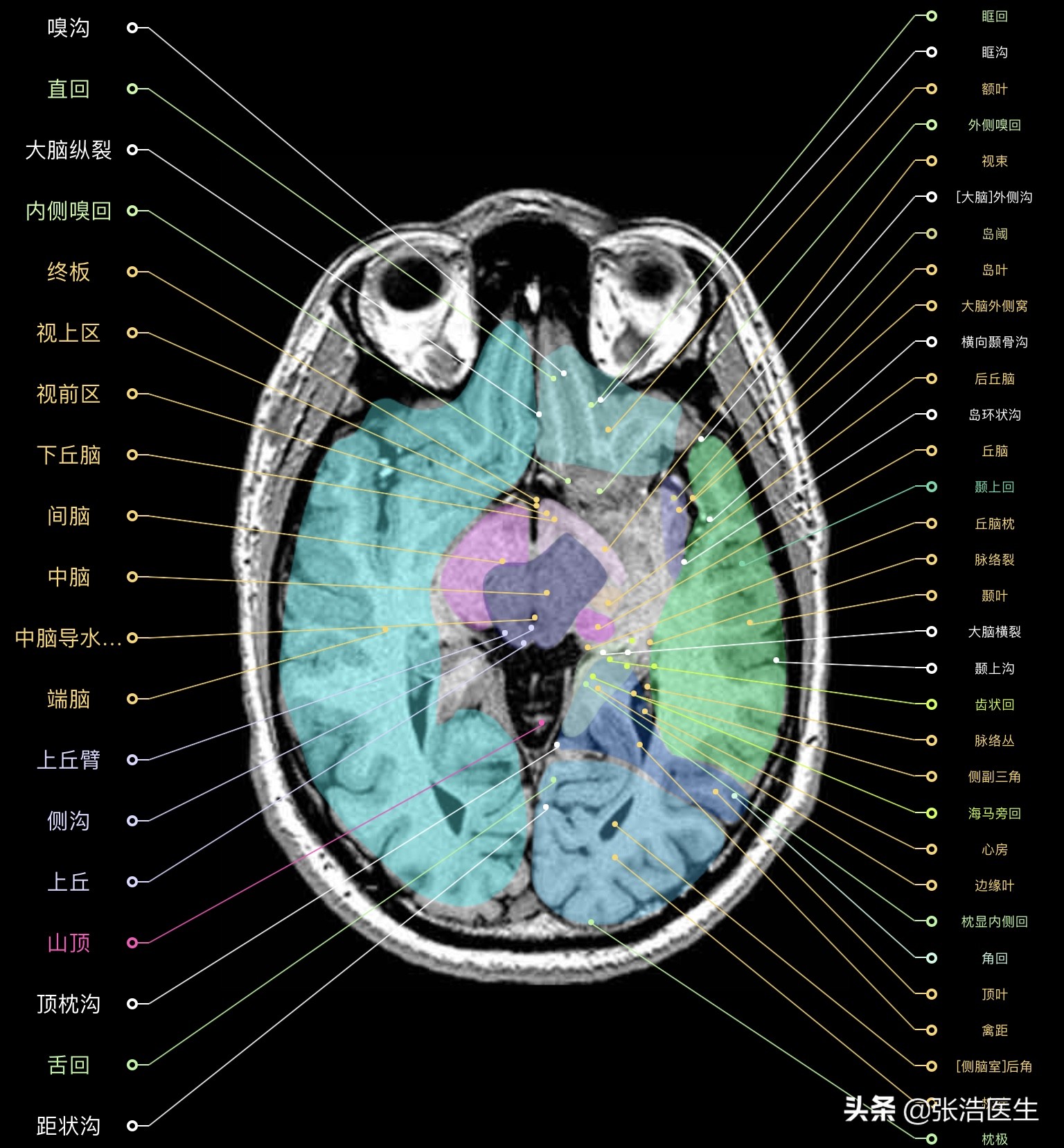 颅脑mri解剖影像检查是什么意思,颅脑mri断层解剖视频课件
