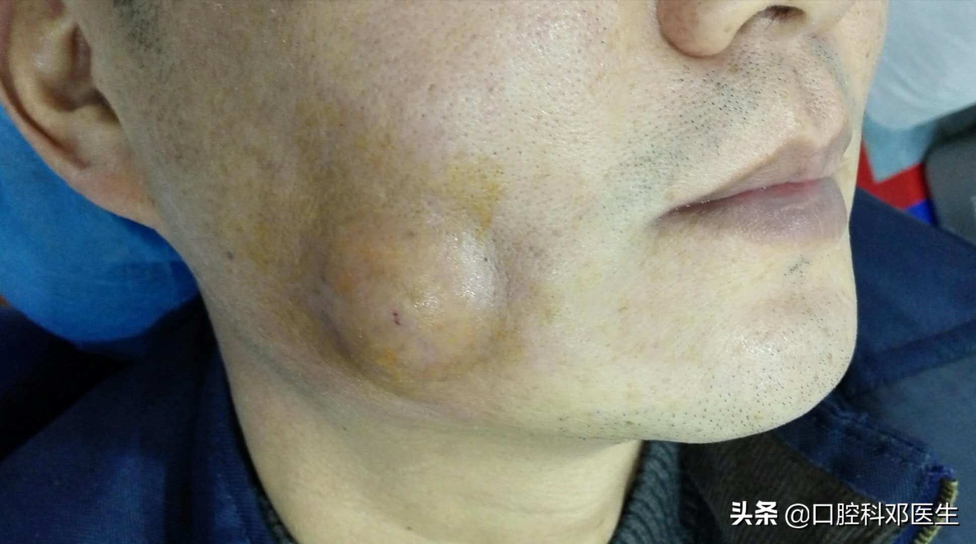 不要让牙齿毁了你的五官,别让一颗牙毁一口牙