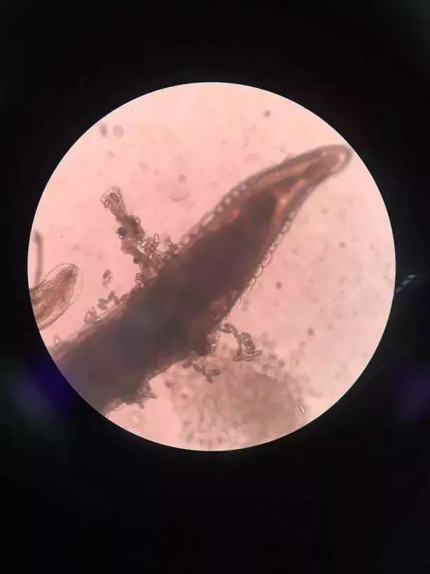 宝宝屁股痒怎样止痒,宝宝屁股痒如何止痒快