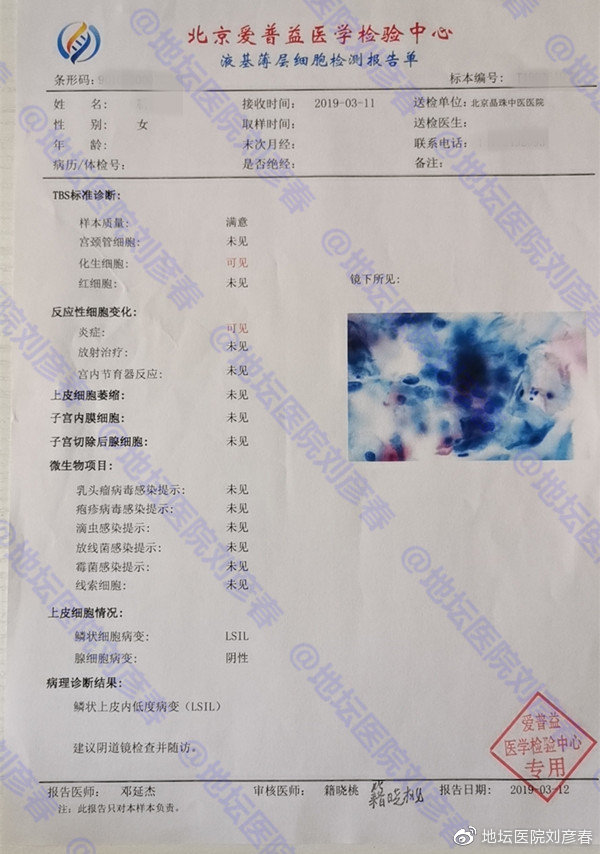 宫颈锥切术后病理还是cin3怎么办,宫颈锥切CIN2后再次病变需要几年