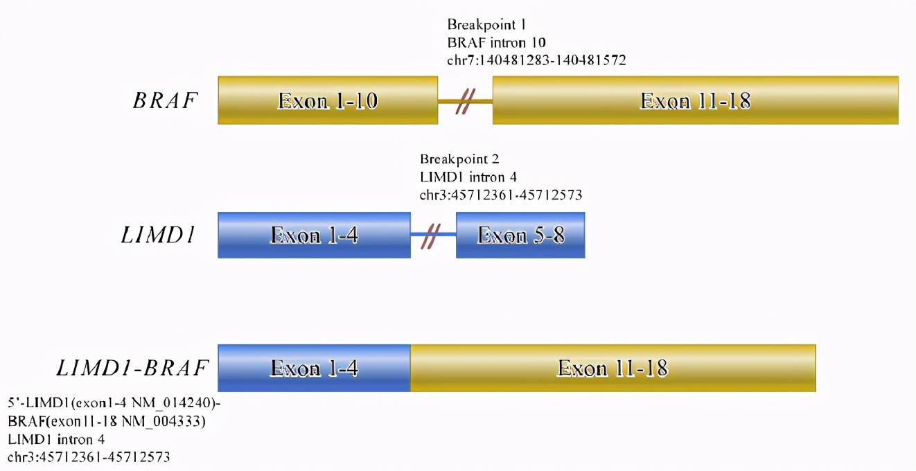 braf基因突变甲状腺癌,braf突变肺腺癌免疫治疗效果