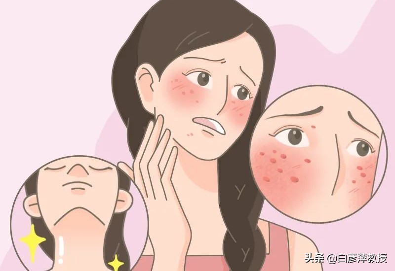 皮肤病乱用药当心雪上加霜,十种不能根治的皮肤病