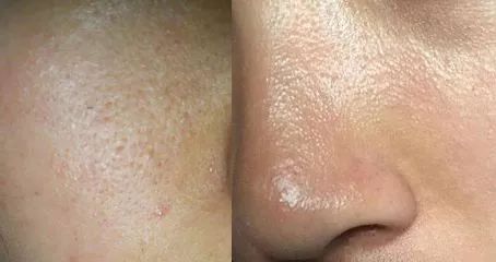 小黄瓜面霜保湿效果好吗,抗老修护保湿面霜澳洲