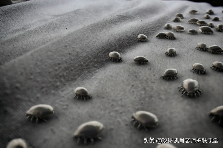 全身被螨虫咬怎么解决,人被螨虫感染了是什么症状