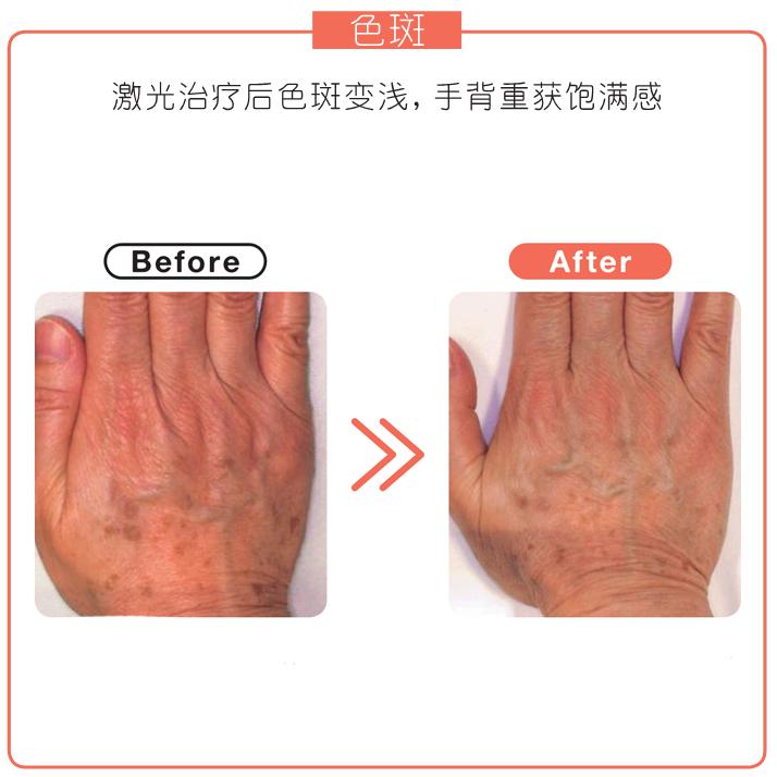 刘宇敷手膜,刘宇敷面膜视频