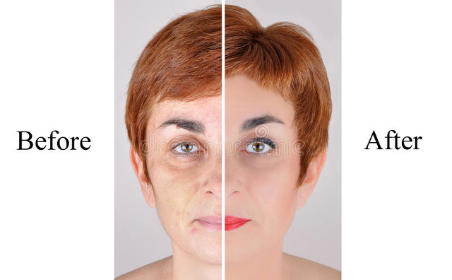 头发稀少者如何增发,中年男人头发稀少增发方法