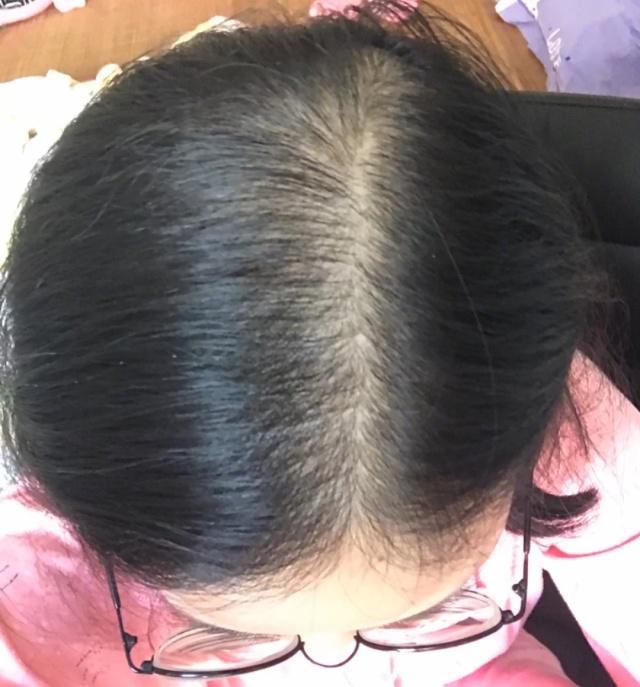 头发太容易出油可以从这4点改善，让你摆脱大油头，清凉一夏