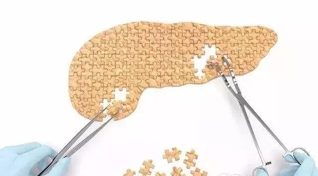 糖尿病人打胰岛素能不能喝酒,血糖高打胰岛素可以喝酒吗