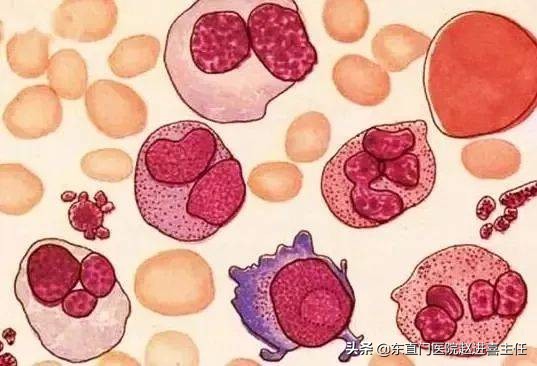 紫癜肾炎可以吃活血化瘀的中药吗,紫癜性肾炎中药方