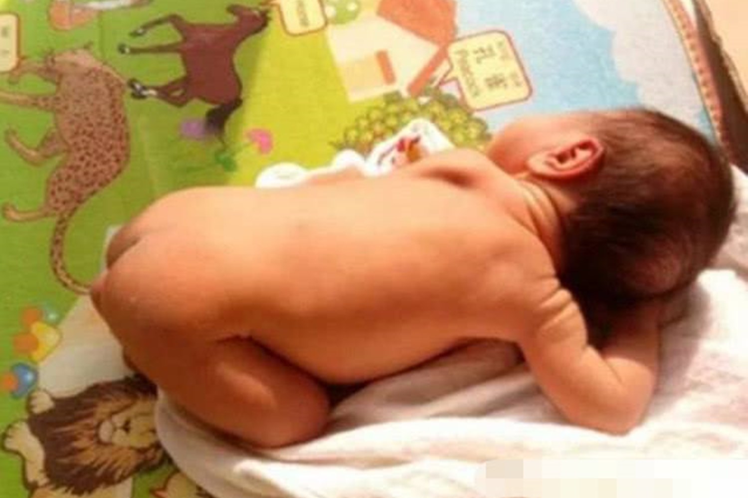 新手妈妈给婴儿做“日光浴”,误伤宝宝皮肤,太阳:这锅我不背