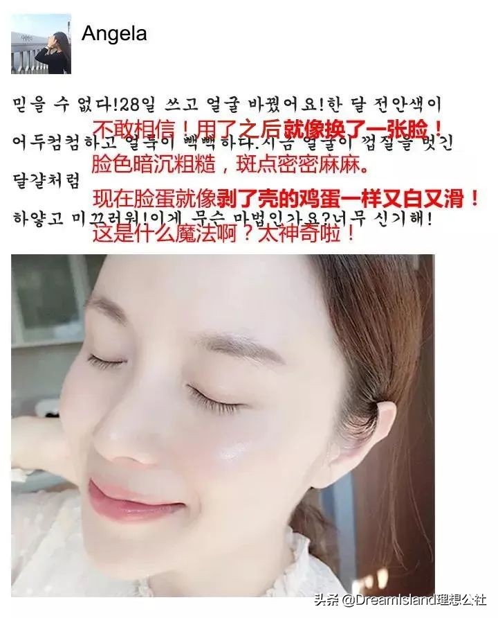 50岁冻龄妈妈有做医美吗,冻龄阿姨保养秘诀