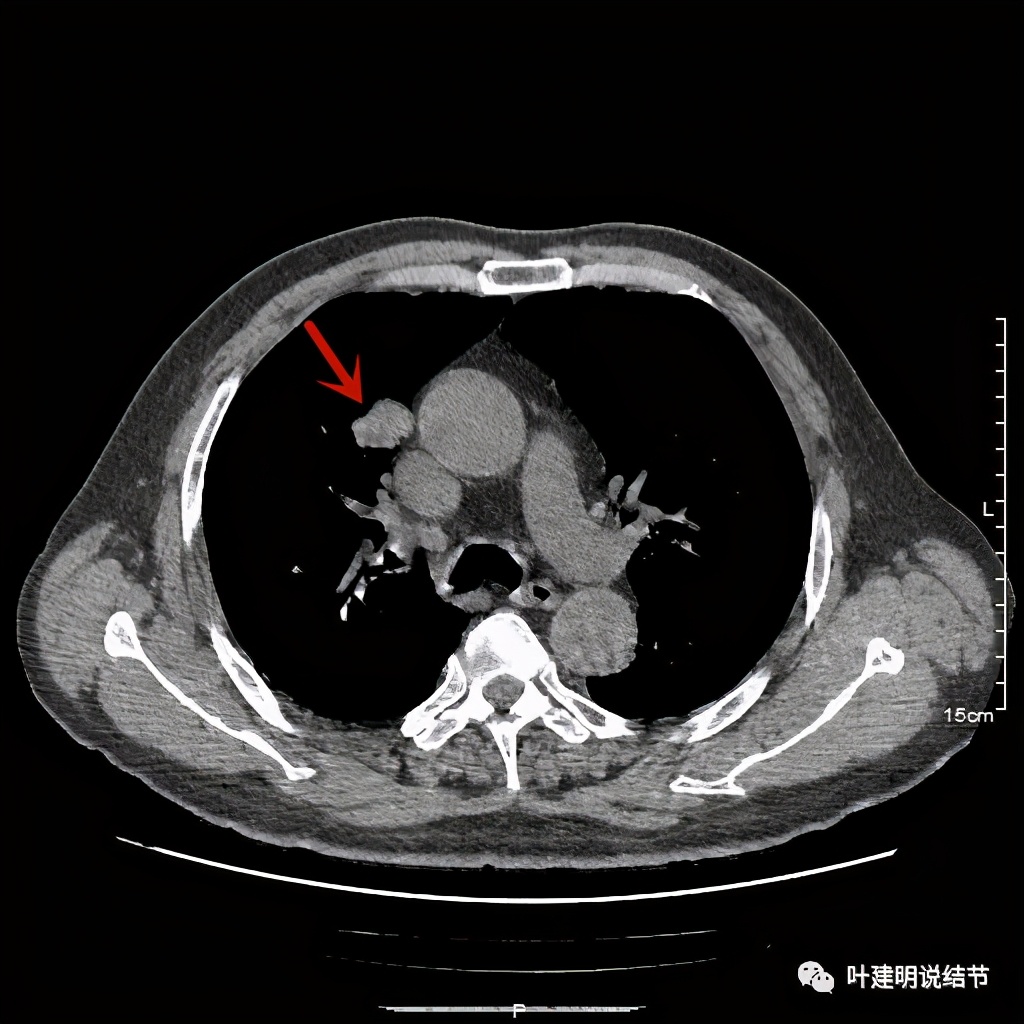 误诊报告图片,误诊案例及案例分析