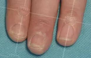 美甲怎么对指甲伤害小,长期美甲怎么保护指甲