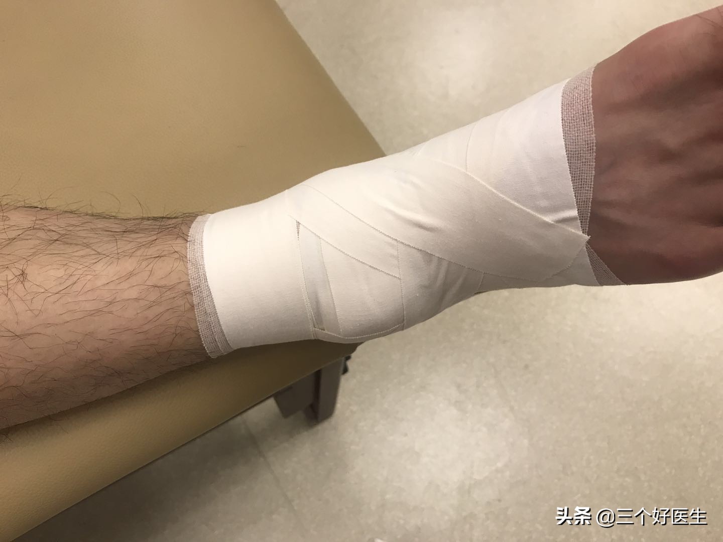 踝关节扭伤肿胀有瘀血需要弄破吗,踝关节扭伤软组织肿胀处理原则