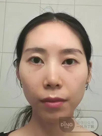 圆胸练成方胸的方法,圆身平胸怎么办