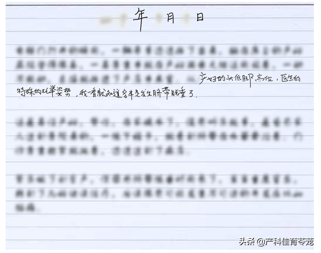 脐带脱垂,破水以后最害怕的事儿