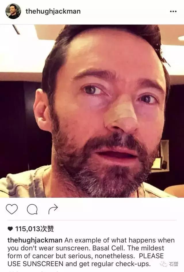 医生提醒的防晒如何做,医生教你防晒怎么涂抹