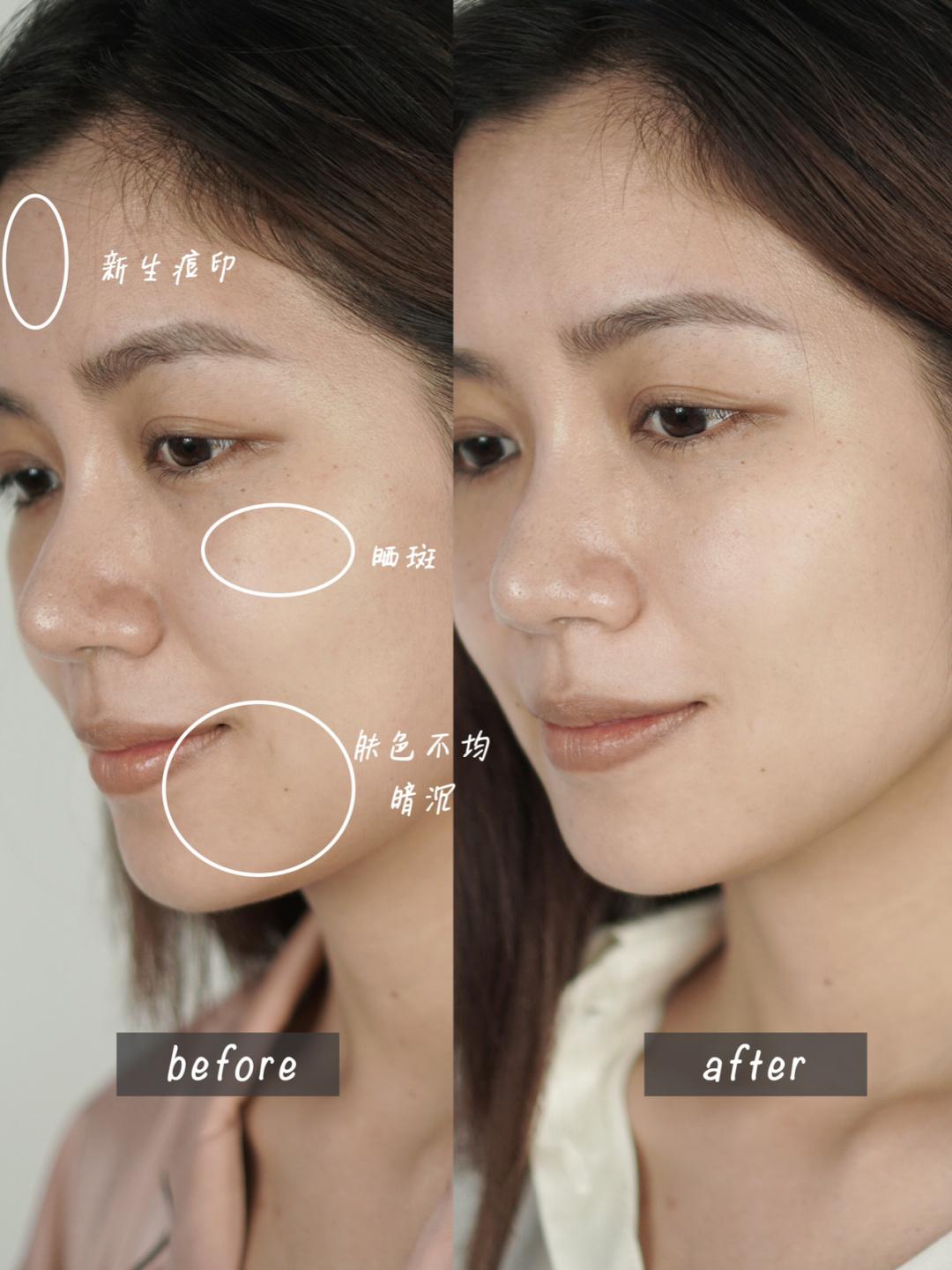 科颜氏提亮美白,小灯泡小银瓶科颜氏淡斑