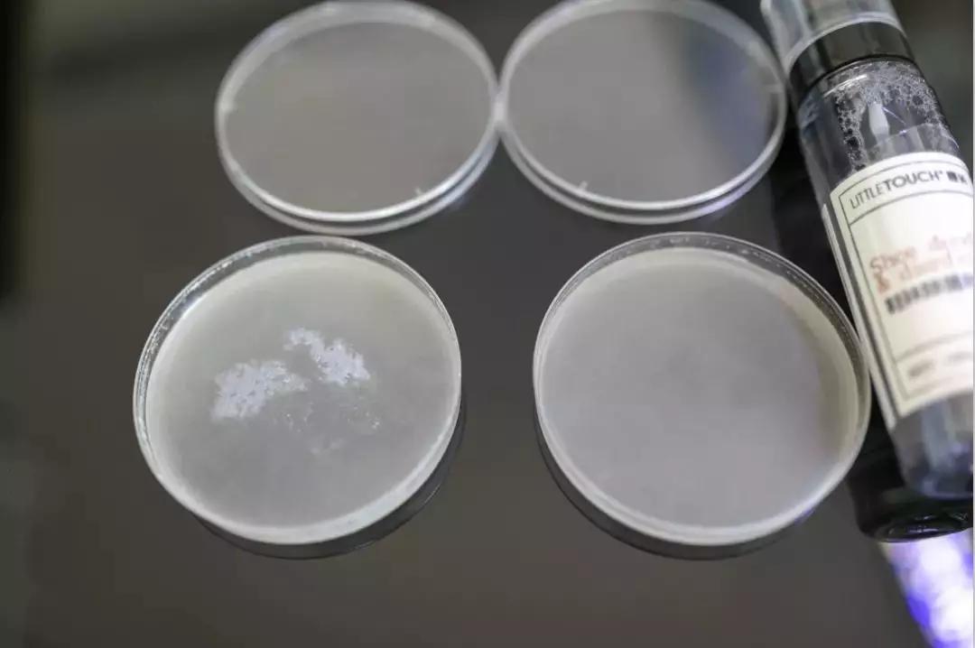 有脚臭怕被人嫌弃的样子该怎么办,老是担心自己脚臭