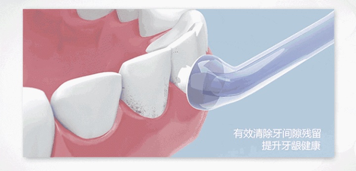 超声波冲牙器是智商税吗,冲牙神器是智商税吗