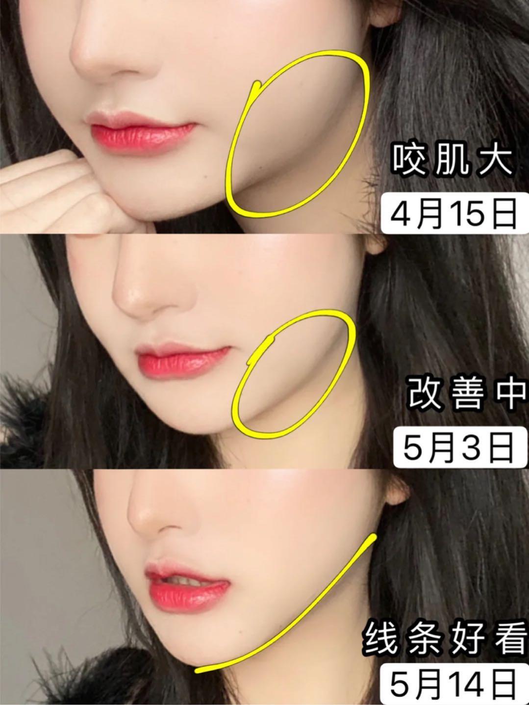 做美容的女人勇气可嘉,打了美容针的女人现在怎么样了