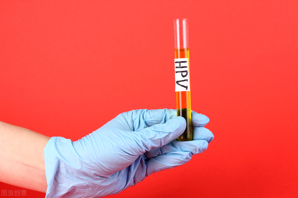 感染hpv就一定有艾滋病吗,健康科普感染hpv一定会得宫颈癌吗