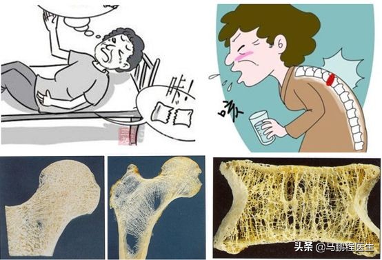 膝关节走路打软怎么回事,走路腿老打闪怎么治疗好