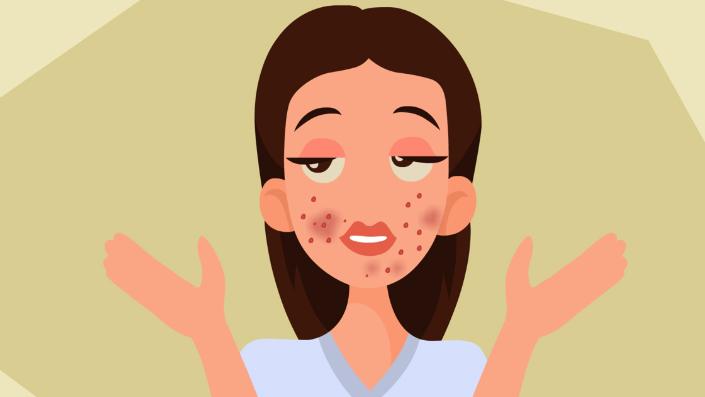 红霉素软膏下面肿可以涂吗,红霉素在眼部涂两下有什么效果