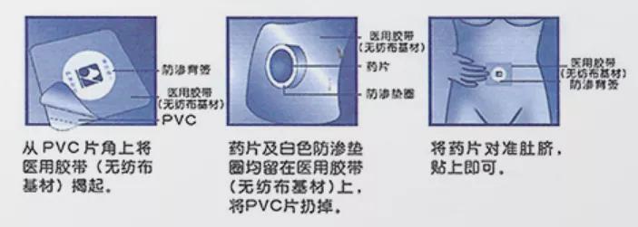 必看！你可能用错痔疮药了