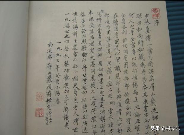 少林祖传跌打损伤秘方,少林真传伤科秘方下载