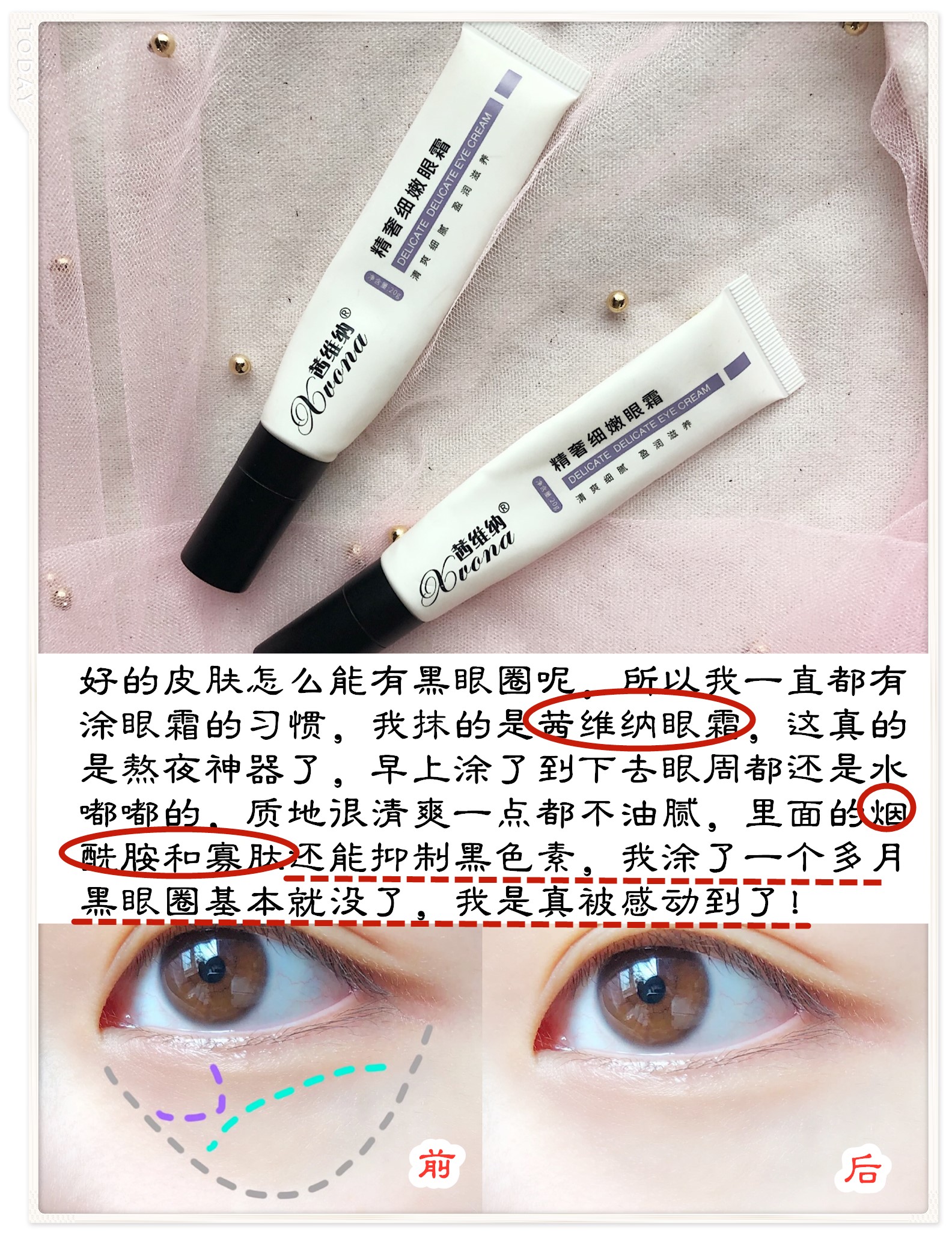 别爱我没结果，除非皮肤好过我，去黑眼圈细纹逆袭漫画眼