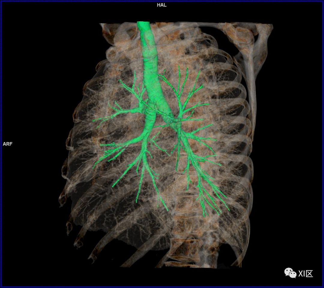 如此详细的肺部影像解剖，有点儿酷！