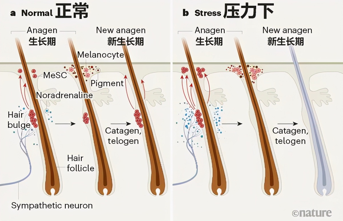 特朗普一夜白发,特朗普白头