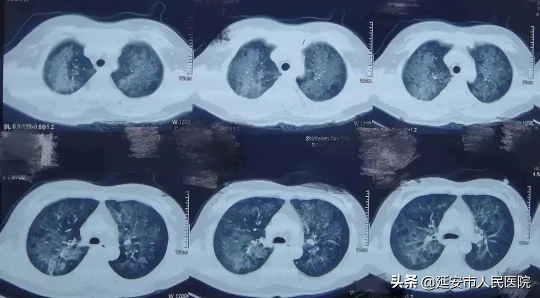 閮戦攼鏁戞湸鑽ｆ仼,閮戦攼鏁戞矆骞垮啗