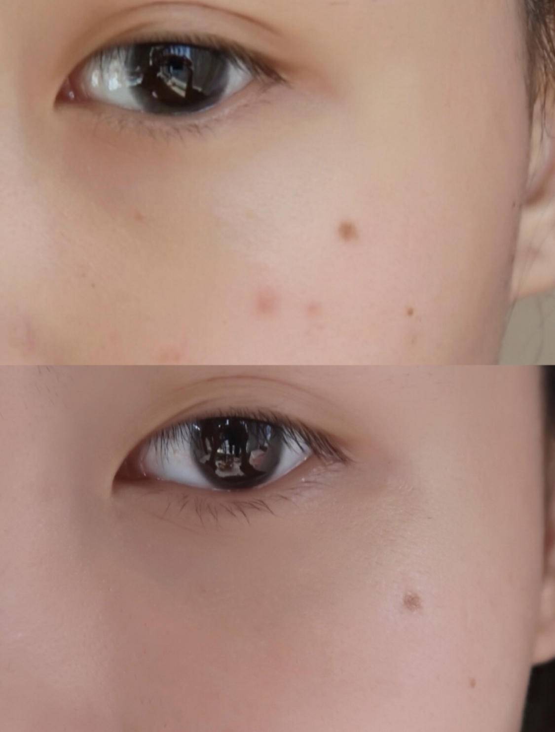 平价抗皱紧致淡化细纹孕妇的眼霜,十大公认好用的眼霜平价