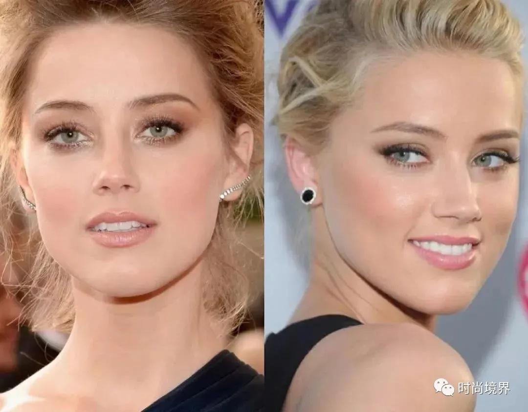 颈纹暴露了你的年龄,颈纹突然严重松弛是胖了还是瘦了