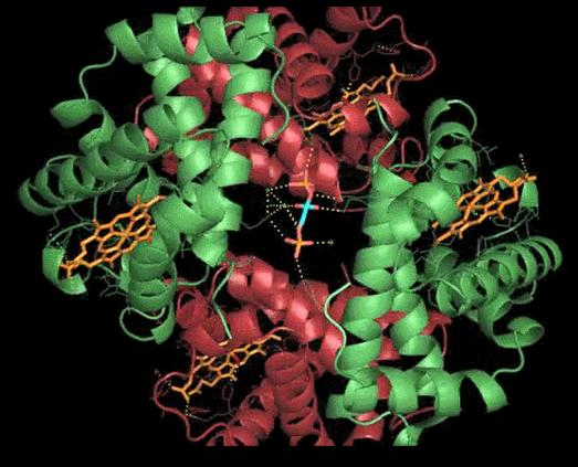 脑功能成像和血管成像,核磁共振脑成像mra是查什么的