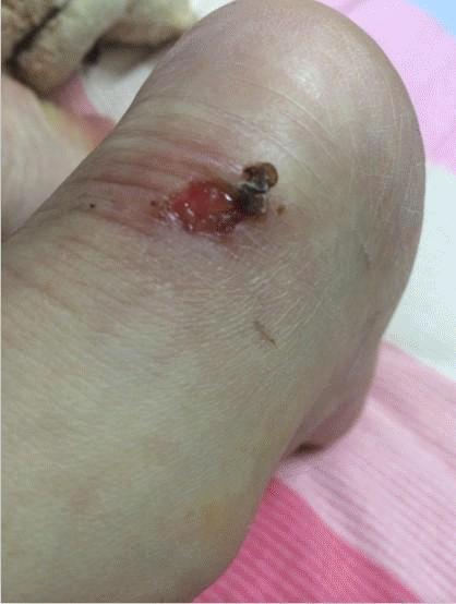 匡威帆布鞋经典款与1970s对比,匡威帆布鞋1970s经典款